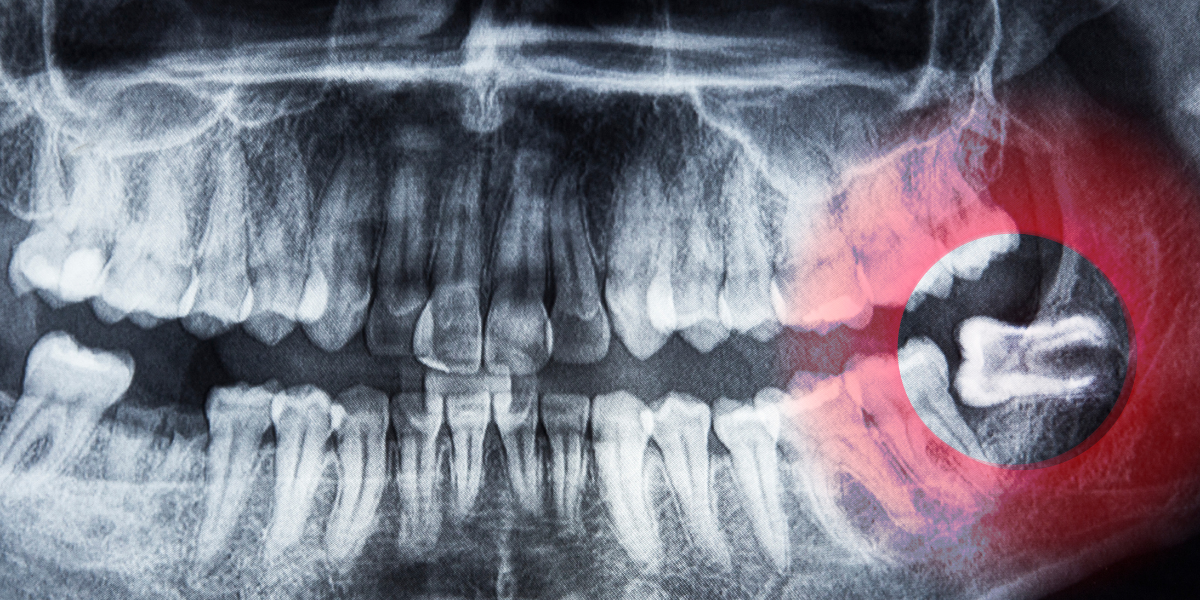 What Are the Most Common Dental Problems You Should Know About